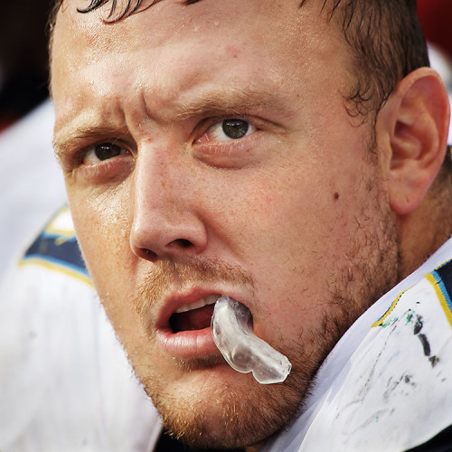 #79 Kenny Wiggins - SAN DIEGO CHARGERS